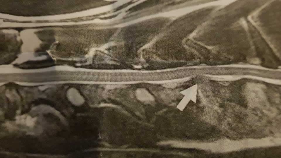 x-ray dog spine