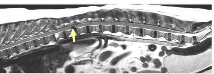 mri dog's spine showing disc lesion Vet extra Neurology